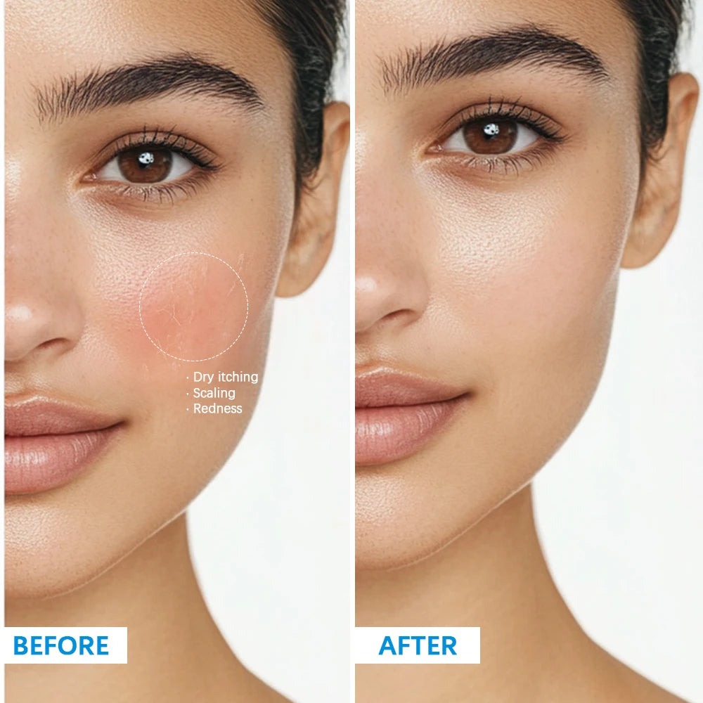 Soothing Multi-Purpose Hydrating Cream Reduces Redness Daily Helps Relieve Rough Cracked Skin Deep Skin Care Oasis Select