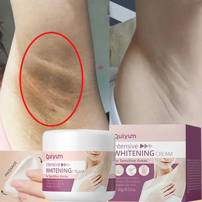 Whitening Cream For Dark Skin Underarm Bleaching Armpit Lightening And Intimate Area Woman Moisturizer Korean Skin Care Products Oasis Select