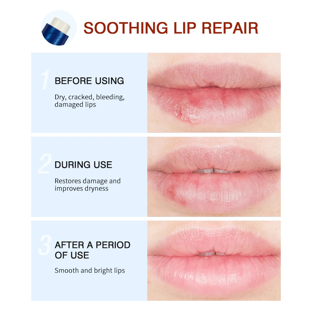 Lakerain Lip Repair Stick 2 Packs Quick Relief Of Dry Moisturizing And Smoothing lip Lines Lip Balm Soothes Chapping Lipstick Oasis Select