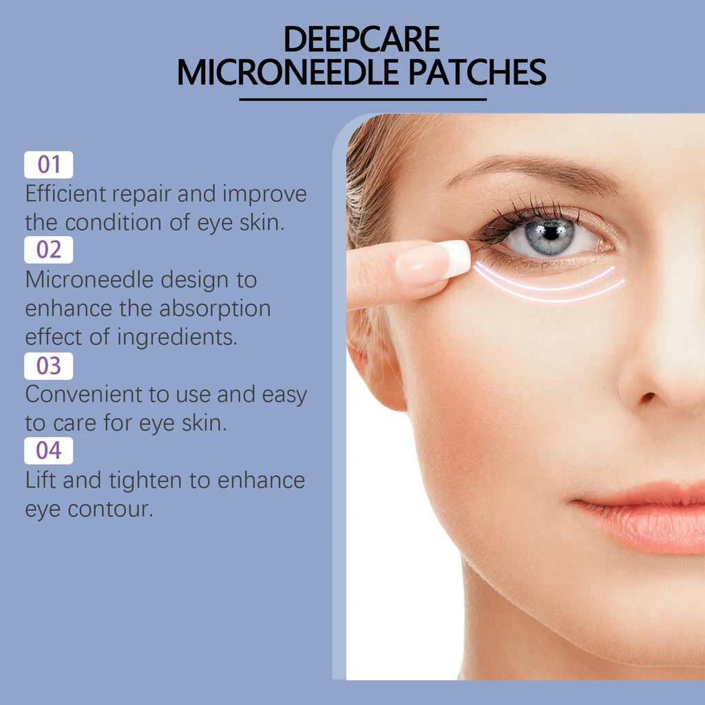 0.25mm Hyaluronic Acid Microneedle Patches Reduce Dark Circles Improve Eye Bags Puffiness Hydrating Anti-Aging Eye Care Oasis Select