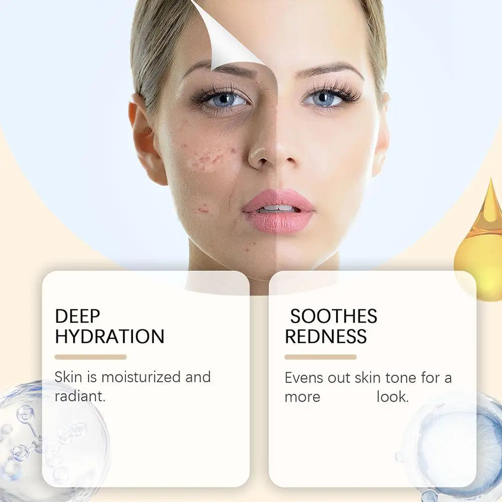 100ml Moisturizing Soothing and Moisturizing Spray Deep Moisturizing, Relieving Redness Nourishing Skin Daily Moisturizing Spray Oasis Select