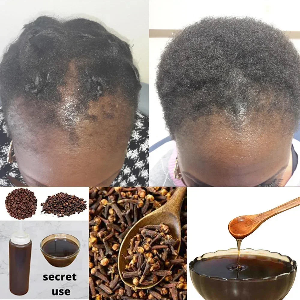 Africa Women Traction Alopecia Treatment Hair Loss Treatment Get Rid of Wigs Hair Growth Product for Men Shampoo 300ml Hair Care Oasis Select Default Title