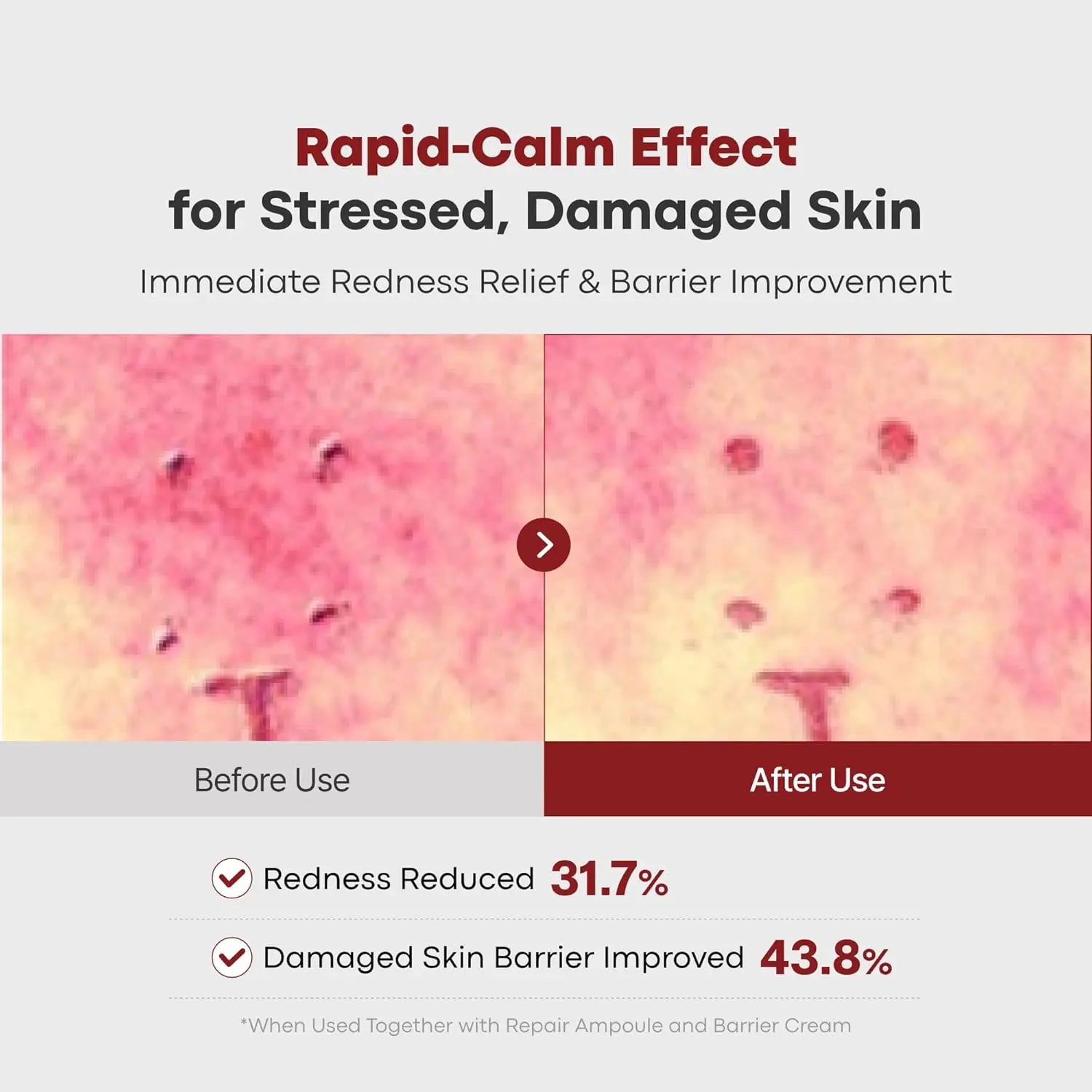 Salmon DNA Collagen Peptide Face Cream | Korean Moisturizer 50g