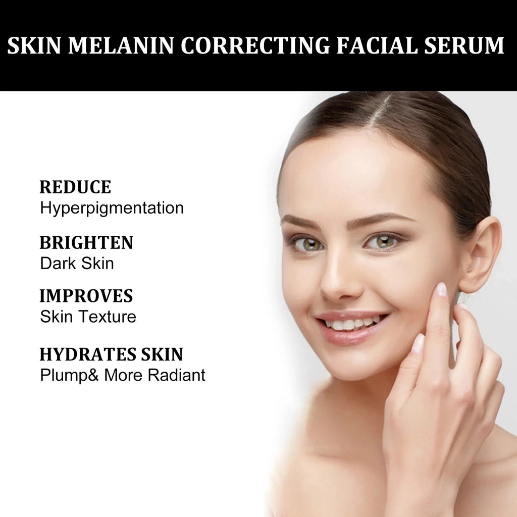 Eelhoe Niacinamide Dark Spot Serum – Fade Pigmentation 30ml Brightening Face Serum Oasis Select