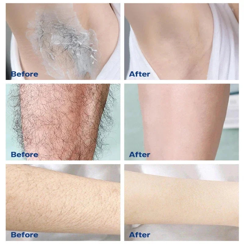 3 Minutes Fast Hair Removal Cream Painless Hair Growth Inhibitor Lip Face Arm Armpit Leg Permanent Depilatory for Men Women Care Oasis Select