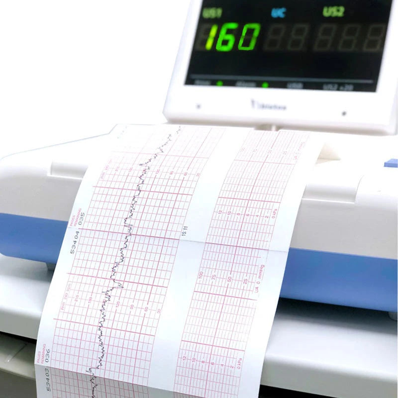 New Sale ECG EKG Machine 50mm*20m/80mm*20/110mm*20m /210mm*20m Electrocardiograph Thermal Printer Paper Oasis Select