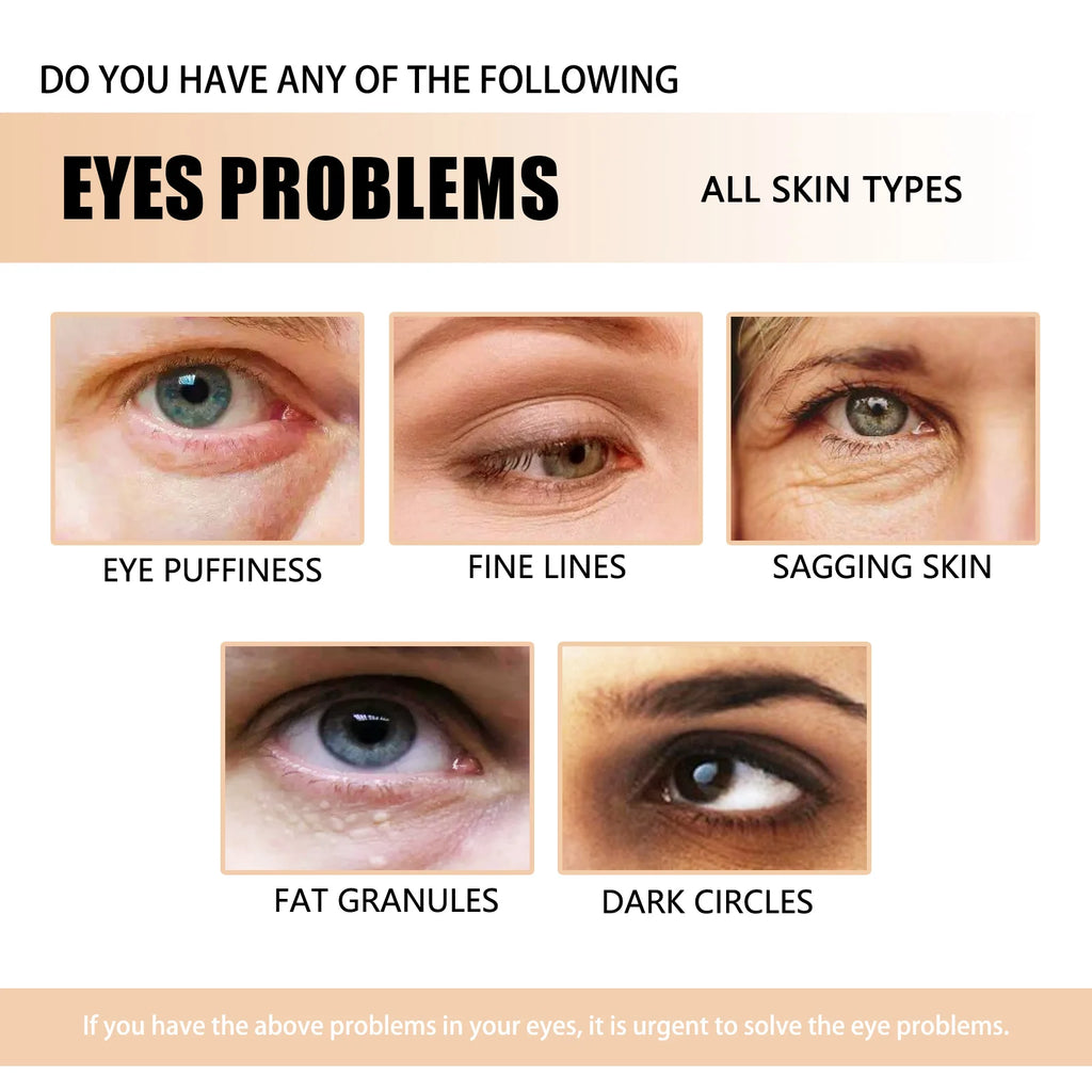 Jaysuing Dark Circle Eye Cream – De-Puff, Brighten & Firm Eye Cream Serum Oasis Select