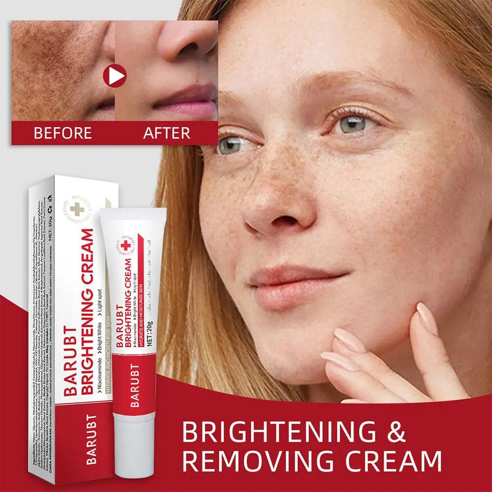 Whitening Freckles Face Cream Removal Melasma Dark Spots Corrector Lighten Melanin Pigmentation Brighten Beauty Care Oasis Select