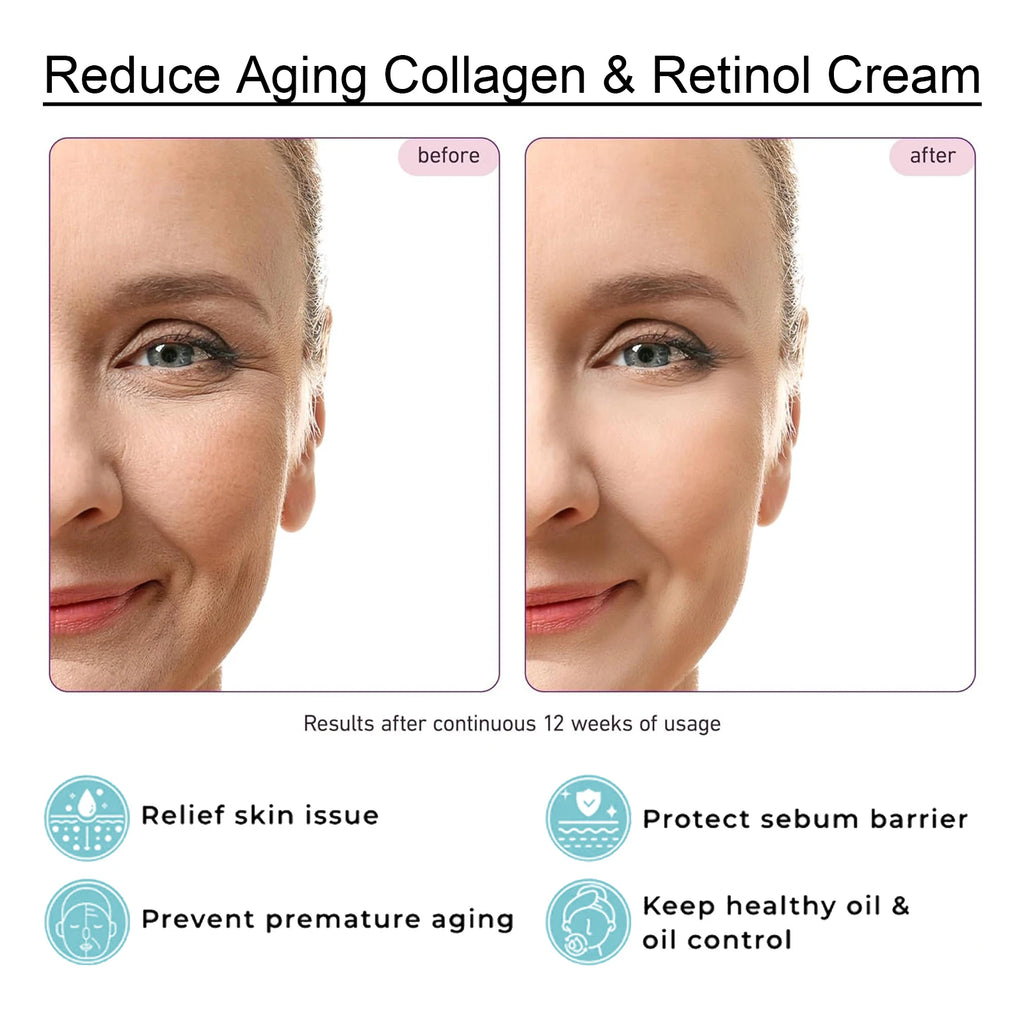 Hoygi Collagen Glutathione Retinol Face Cream 50g – Anti-Aging