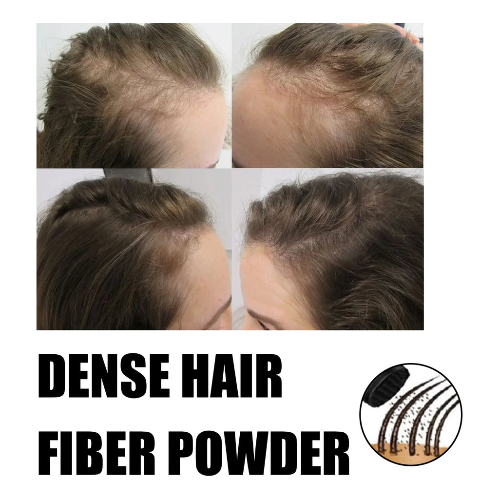 EELHOE Dense Hair Fiber Increase Hair Loss Concealer Instant Hair Shading Powder Hairline Enhancement Hairline Shadow Powder 12g Oasis Select