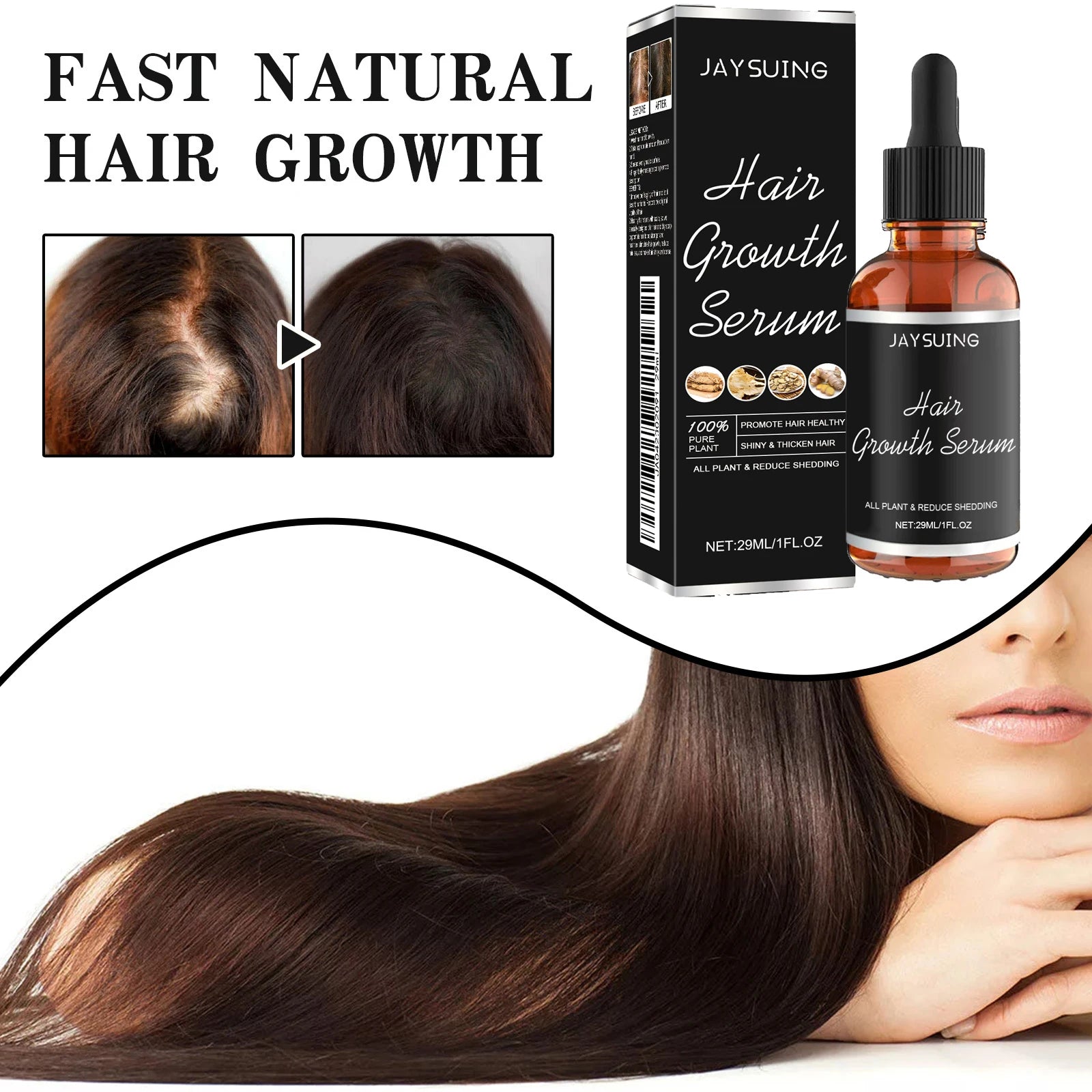 Jaysuing Hair Loss Reducing Essence – Nourishing Scalp Oil Hair Loss Serum Oasis Select