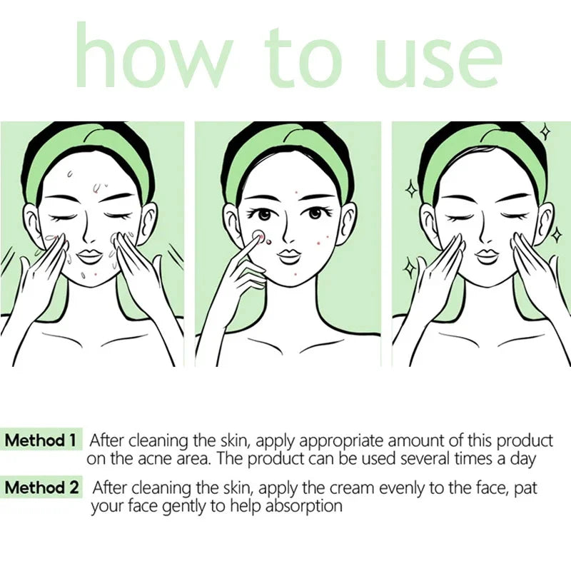 Herbal Acne Face Cream – Pore Minimizing & Skin Brightening Gel Acne Gel Cream Oasis Select