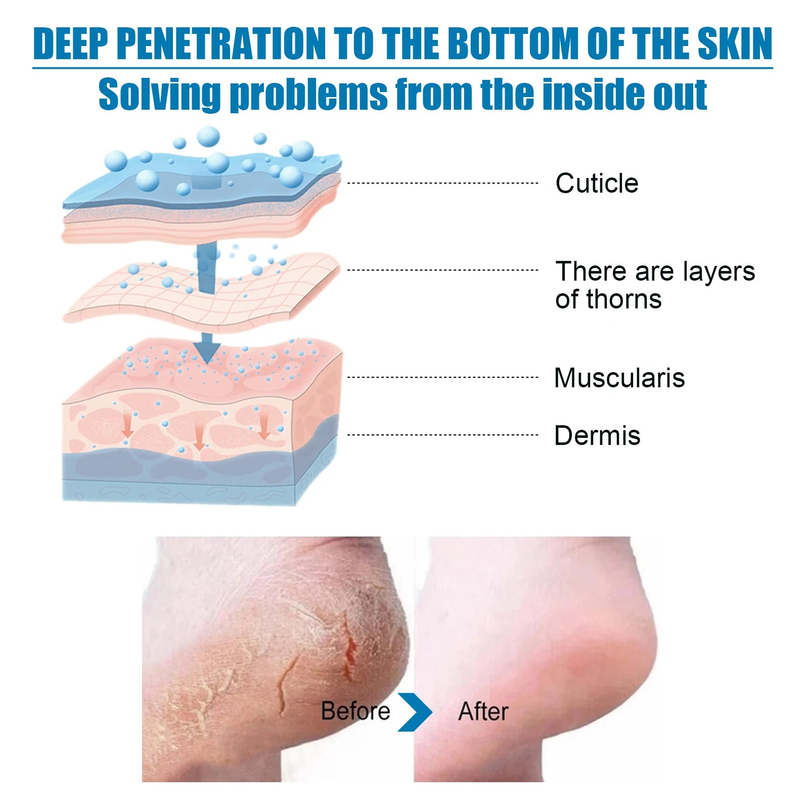 Exfoliating Foot Peel Mask – Remove Calluses & Dead Skin Foot Peel Mask Oasis Select