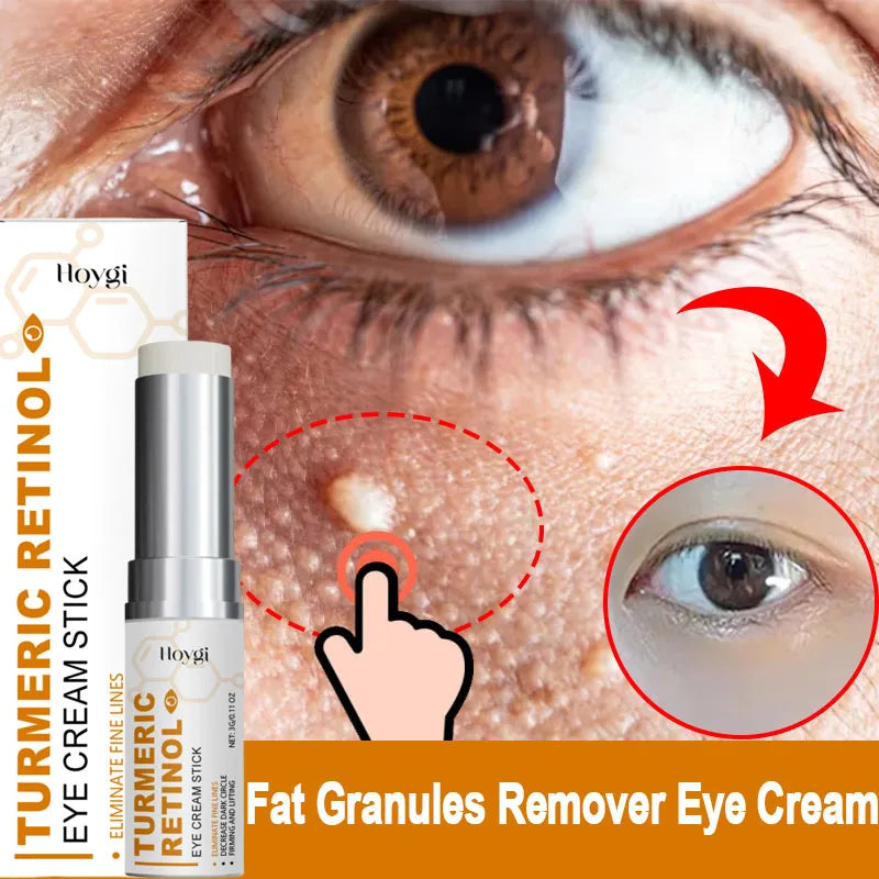 Hoygi Eye Cream | Dark Circles, Puffiness & Fine Lines Eye Cream Oasis Select