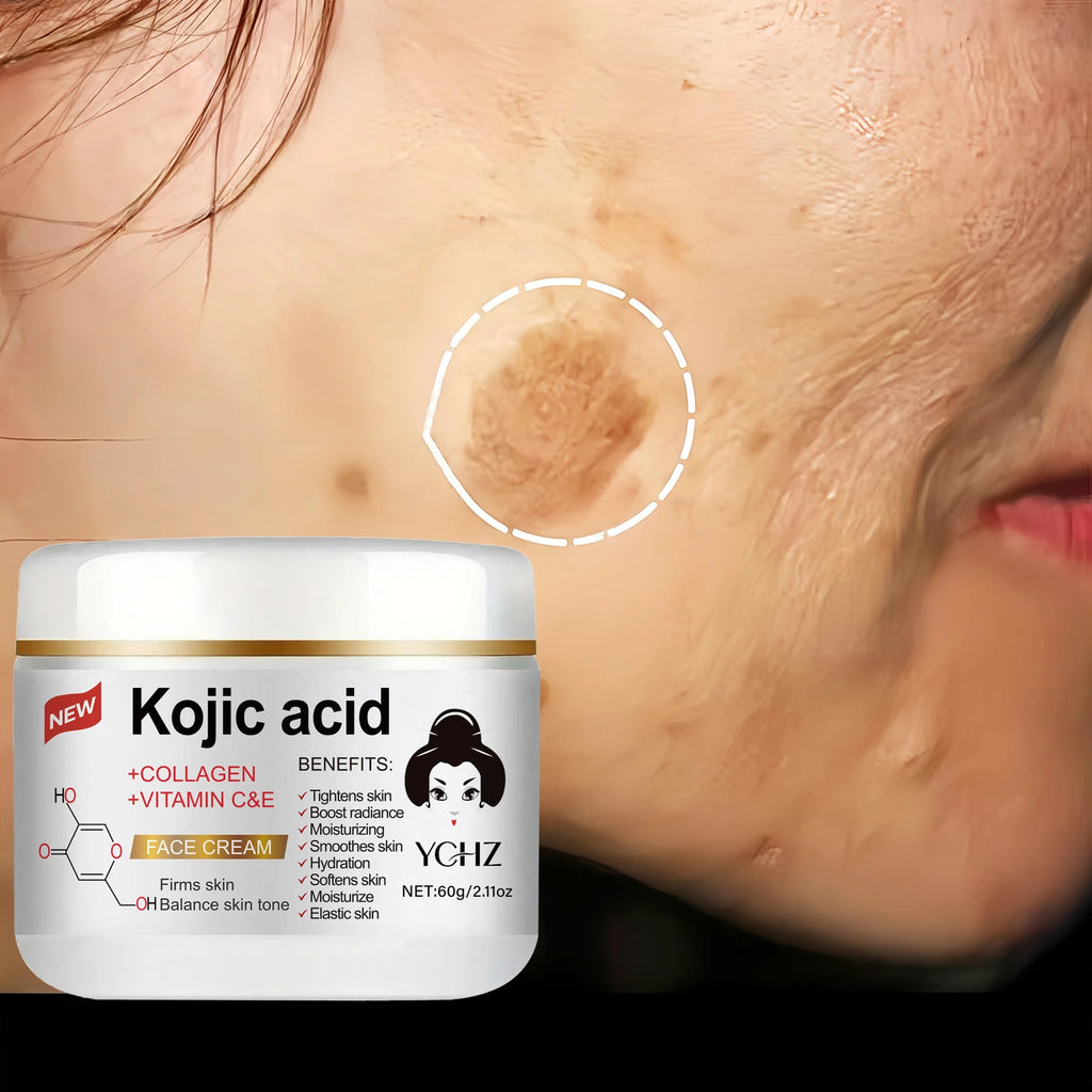YCHZ Kojic Acid Brightening Cream 60g – Even Skin Tone & Glow