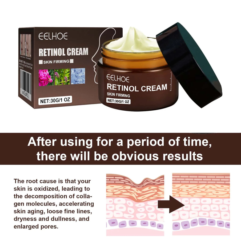 Eelhoe Double Retinol Face Cream – Anti-Aging & Brightening Anti-Aging Face Cream Oasis Select