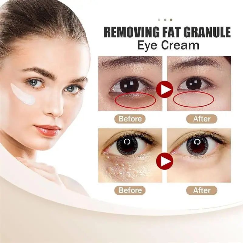 Hoygi Eye Cream | Dark Circles, Puffiness & Fine Lines Eye Cream Oasis Select