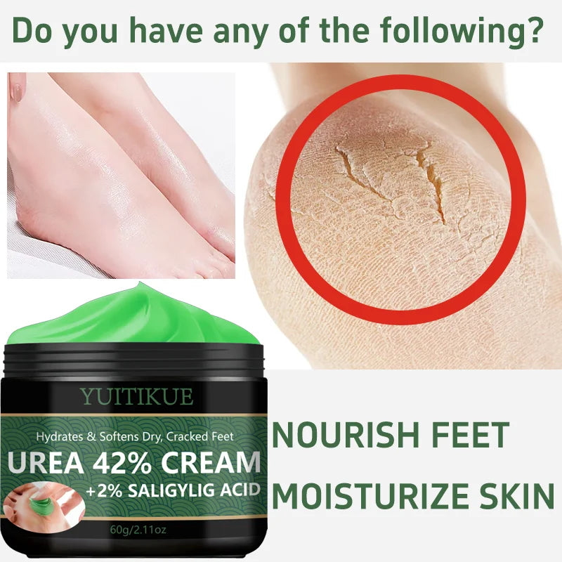 YUITIKUE 42% Urea Foot Cream – Callus & Dry Heel Repair