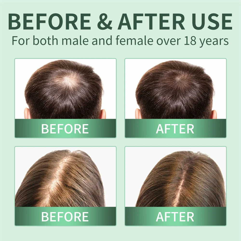 Rosemary Scalp Scrub Shampoo & Hair Growth Serum Spray Hair Growth Set Oasis Select