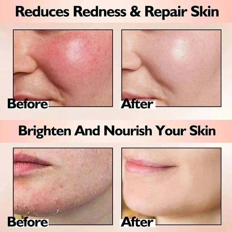 SADOER B5 Repair Cream – Vitamin B5 & Centella Moisturizer 40g Barrier Repair Cream Oasis Select
