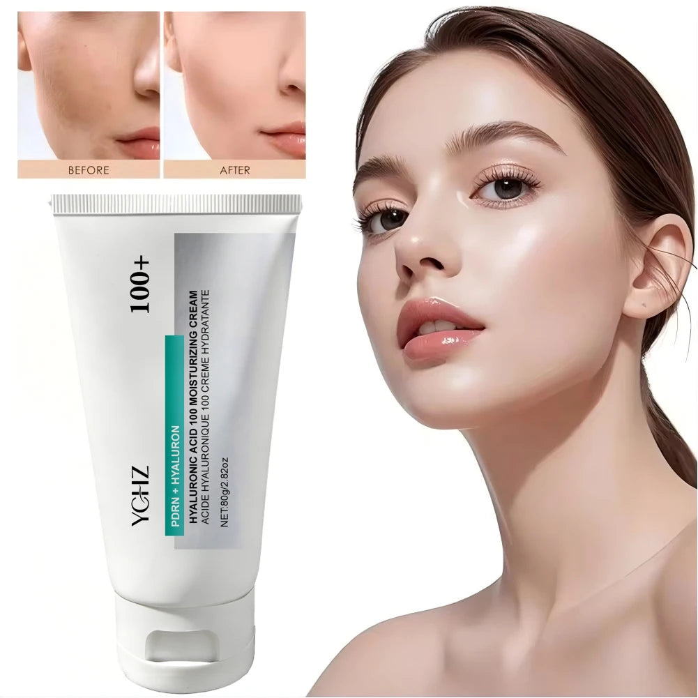YCHZ Hyaluronic Acid Moisturizing Cream – Korean Skincare 80g