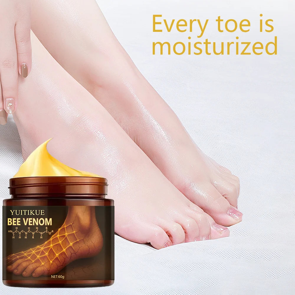 Urea Foot Cream 100g – Dry Heels, Hands & Elbows Relief