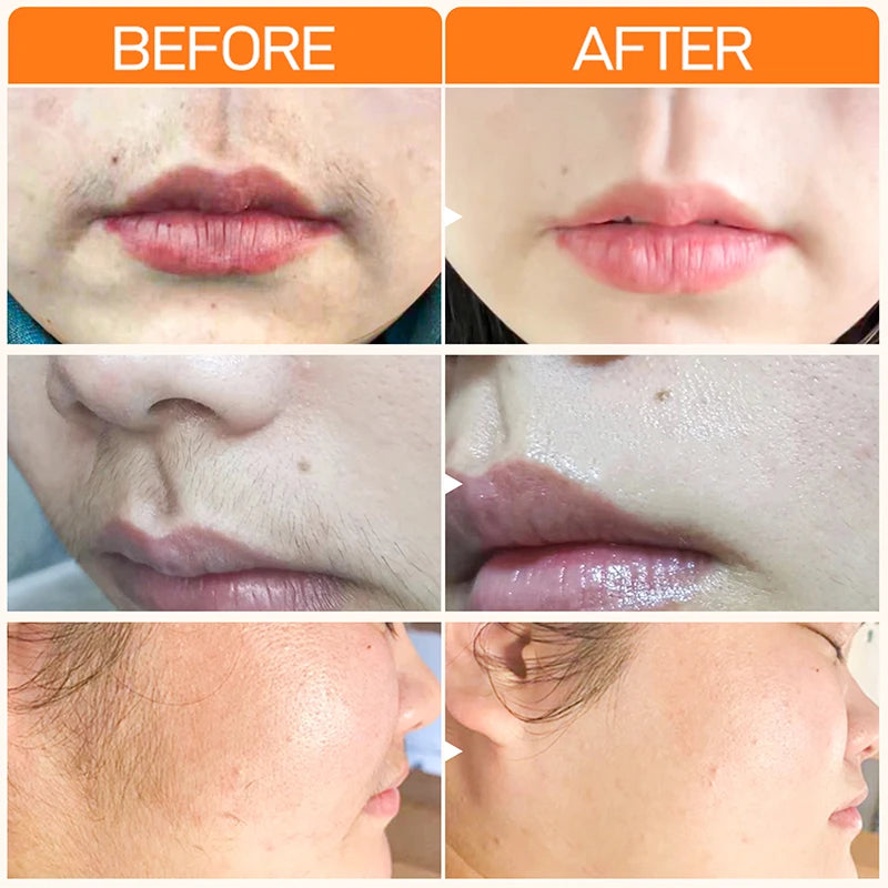 Painless Depilation Cream Hair Removal Wax Lip Intimate Areas Epilator Cream Health Depilatory Care Hair Growth Inhibitor Oasis Select