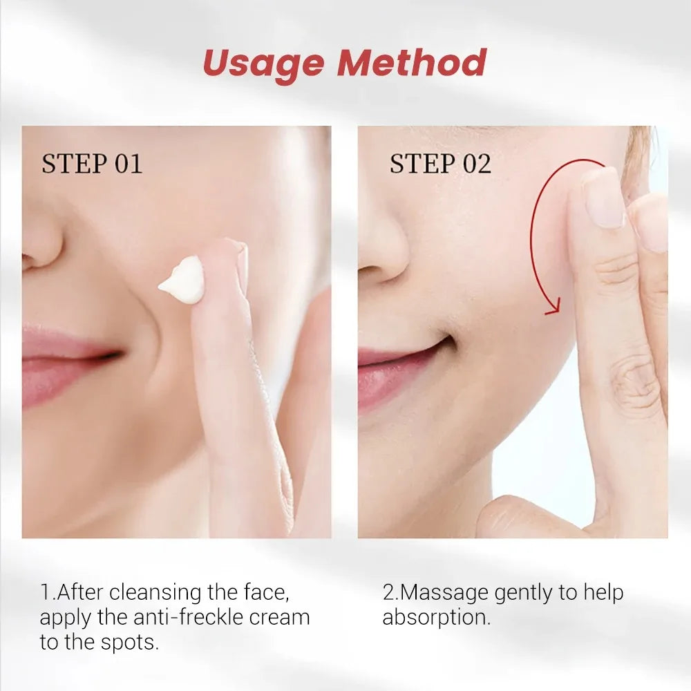 20g Whitening Freckle Cream Remove Dark Spot Cream Anti Freckle and Aging Cream Fade Pigmentation Melasma Brighten Serum Skin Oasis Select