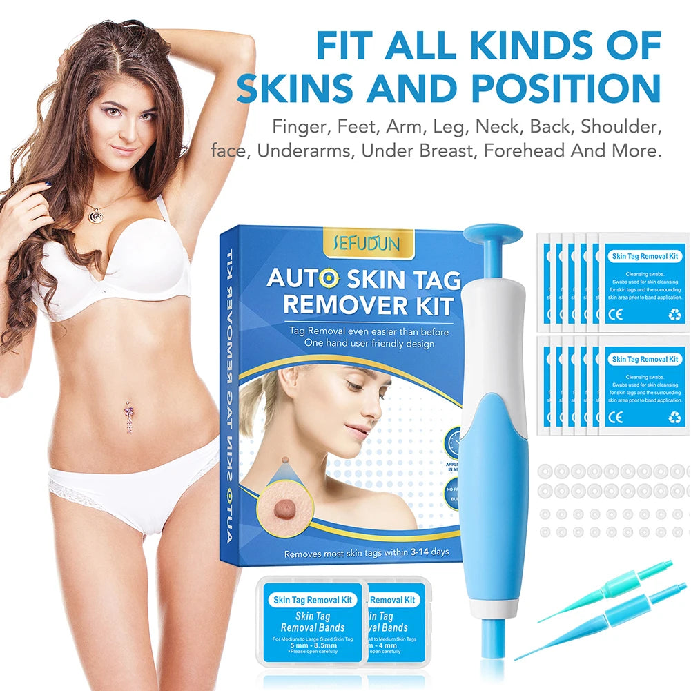2-in-1 Skin Tag Remover Kit – Painless Wart & Mole Tool Skin Tag Remover Oasis Select
