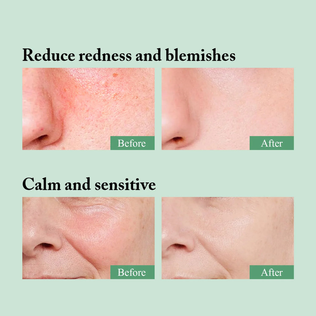 Centella Asiatica Toner 120ml – Hydrating Sensitive Skin Toner