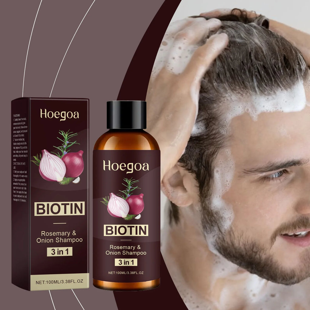 HOEGOA Red Onion Shampoo – Scalp Repair & Anti-Dandruff Anti-Dandruff Shampoo Oasis Select