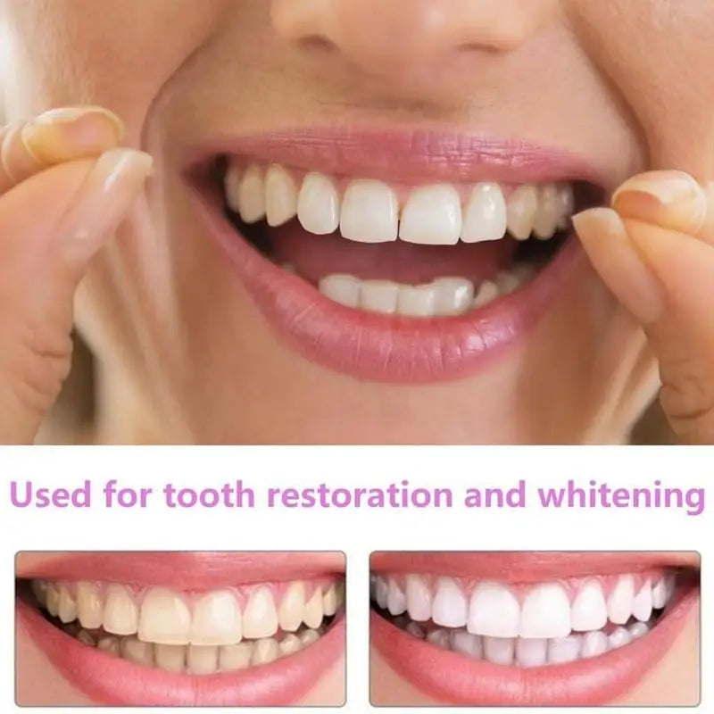 Snap-On Teeth Veneers – Reusable Smile Cover for Men & Women Cosmetic Dental Veneers Oasis Select