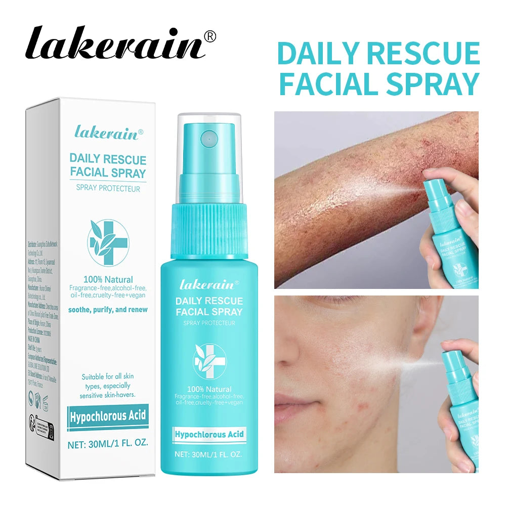 30ml Rescue Facial Spray For Sensitive Skin Hypochlorous Acid Spray Helps Reduce Redness Breakouts Soothing Balancing Spray Oasis Select
