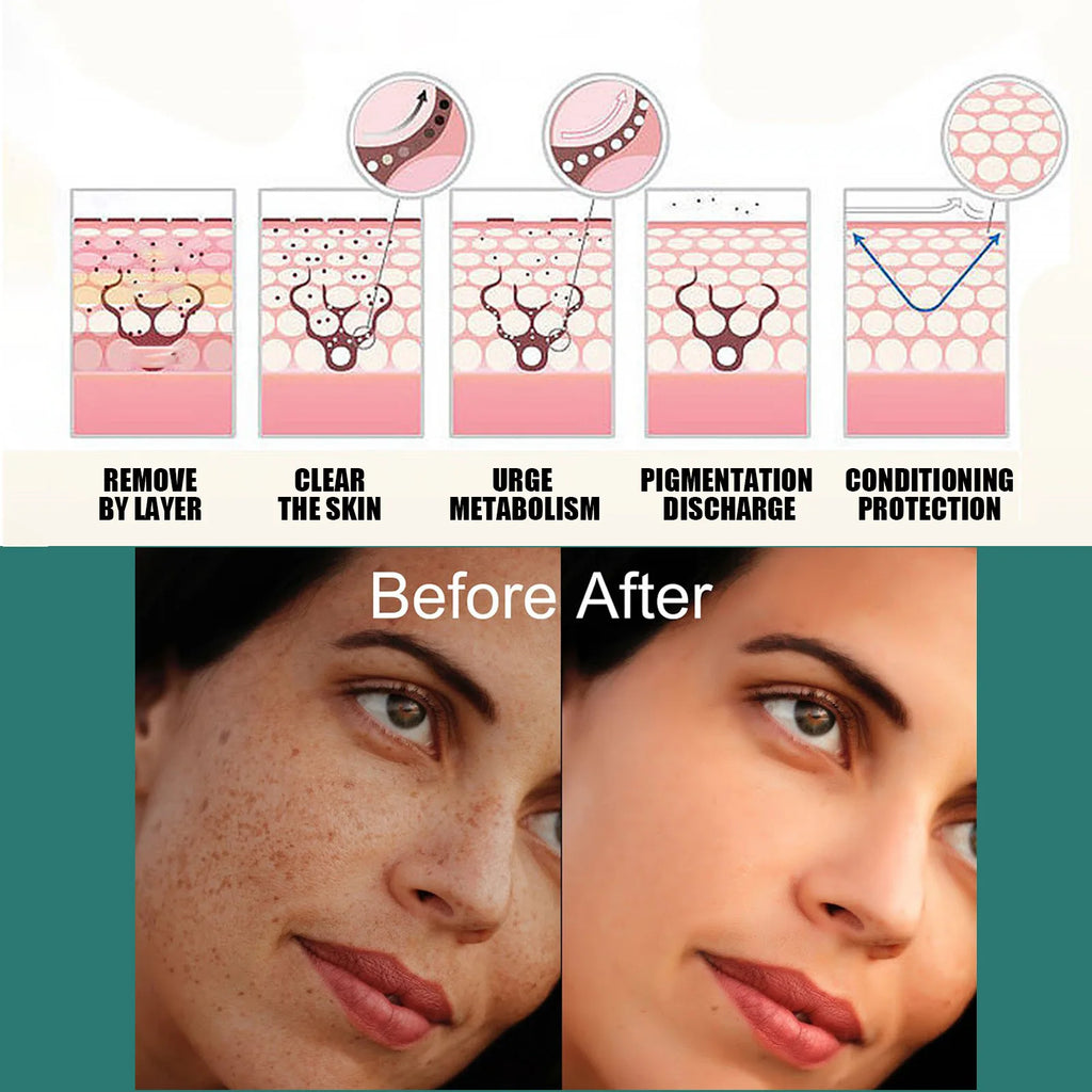 Eelhoe Vitamin C Face Cream – Dark Spot & Brightening Corrector