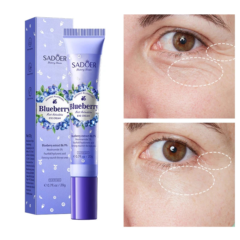Blueberry Eye Cream – Moisturizing, Firming & Brightening Eye Cream Oasis Select
