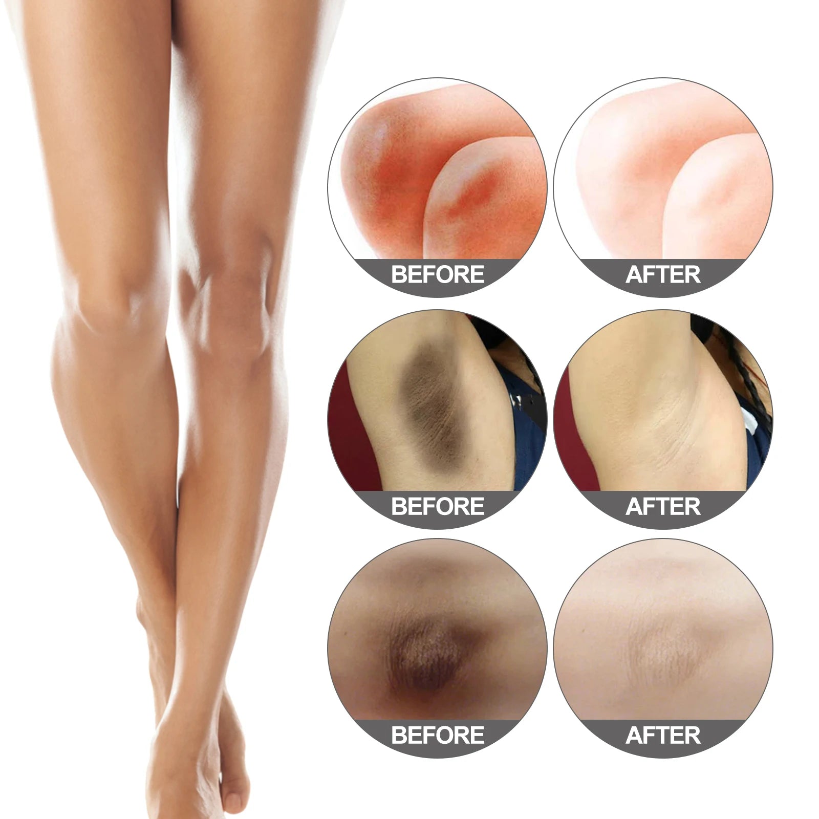 Body Snow Bleach Cream Nicotinamide Brighten Private Parts Underarm Bleaching Armpit Elbow Knees Joint Removal Dark Spot Melanin Oasis Select