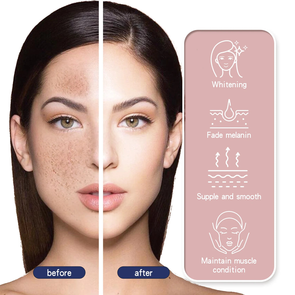 Hoygi Brightening Spot Fade Moisturizer – Dark Spot Cream