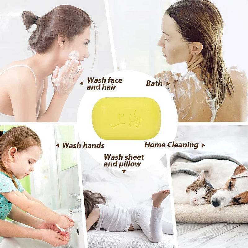 2026 Flash Sale！3/5Pcs Shanghai Sulfur Soap Traditional Chinese Skin Care Oil-Control Acne Cover Cleanser For Glowing Skin Oasis Select