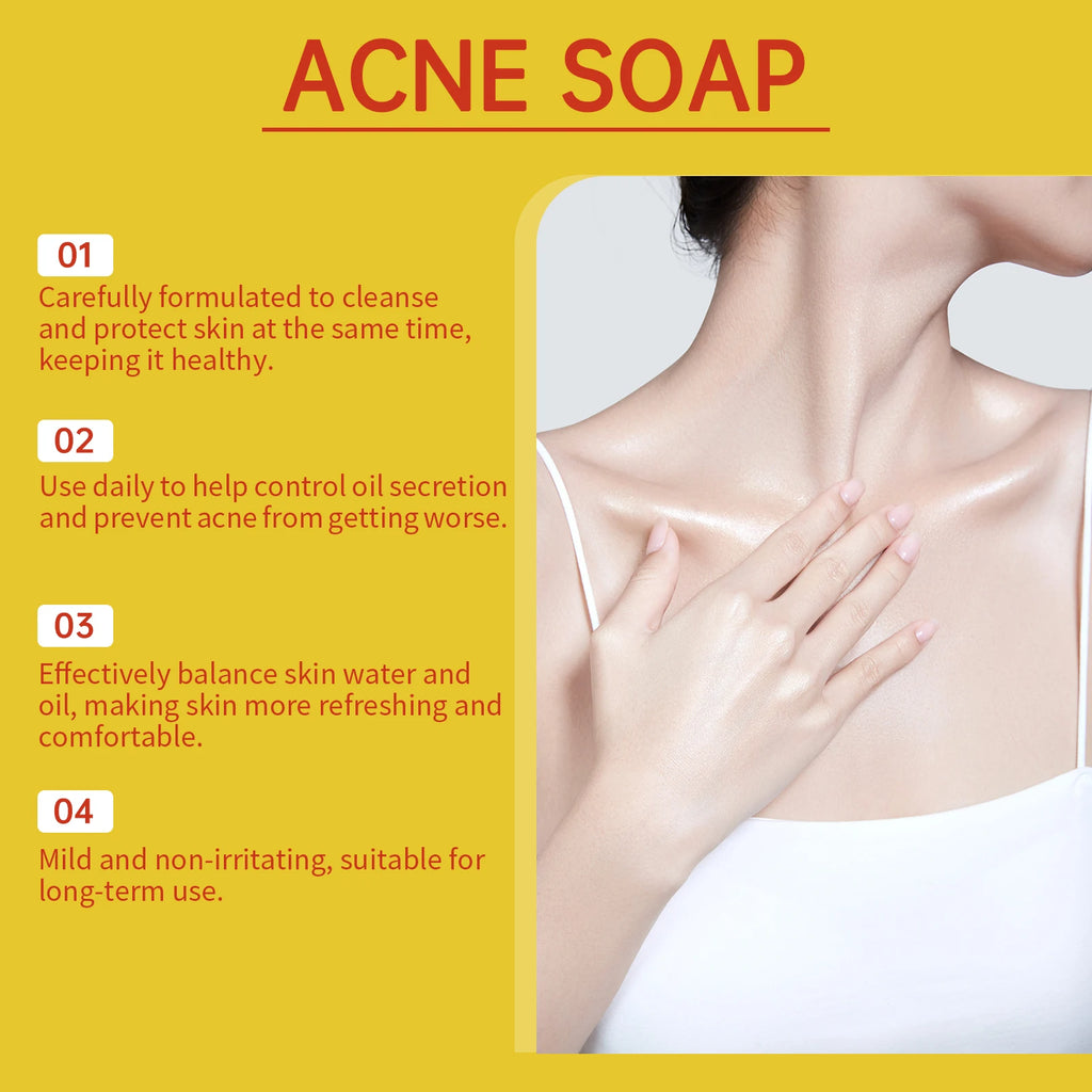 Jaysuing Acne Treatment Soap – Oil Control & Skin Lightening 100g Acne Cleansing Soap Oasis Select
