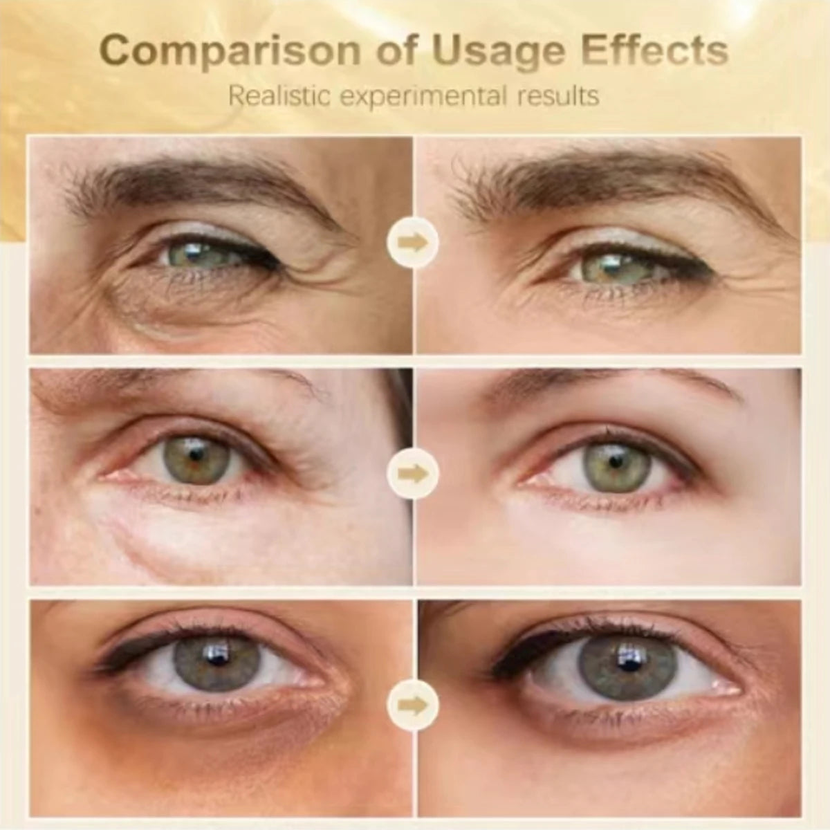Retinol & Hyaluronic Acid Eye Cream – Anti-Aging & Dark Circles Anti-Aging Eye Cream Oasis Select