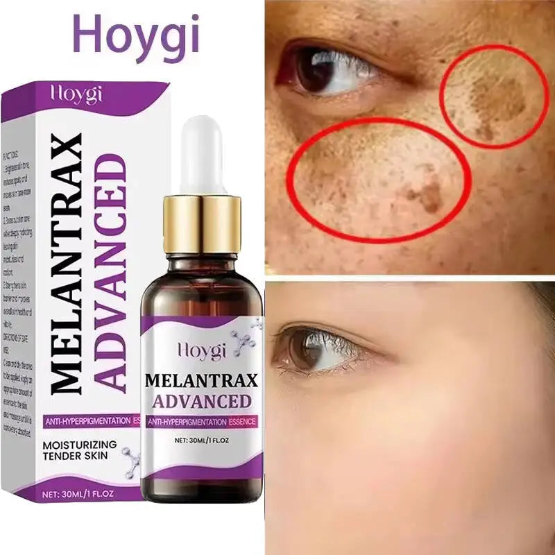Hoygi Niacinamide Facial Serum Vitamin B3 Wrinkles Pigment Dark Spot Removal Correcting Glow Serum Face Whitening Moisturizer Oasis Select
