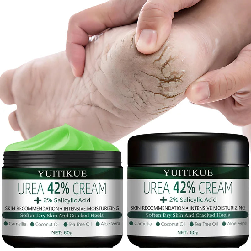 YUITIKUE 42% Urea Foot Cream – Cracked Heels & Dry Skin