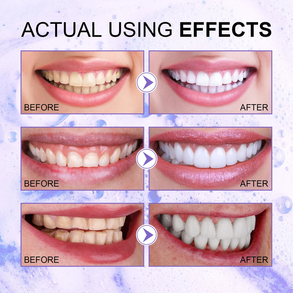 Purple Toothpaste Teeth Brightening Whitening Toothpaste Serum Deep Cleaning Teeth Fresh Breath Oral Oasis Select