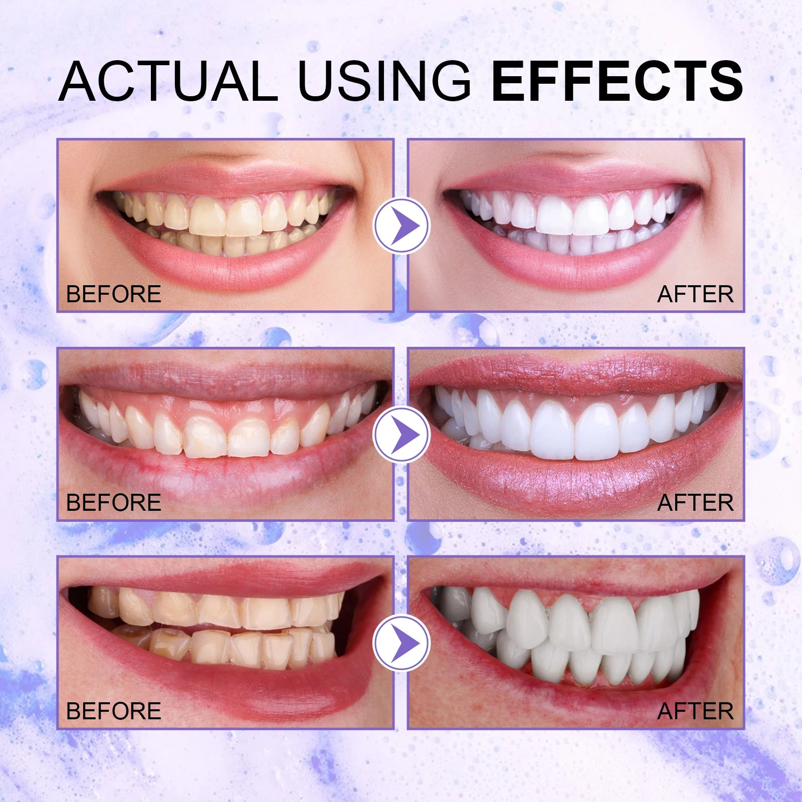 Purple Toothpaste Teeth Brightening Whitening Toothpaste Serum Deep Cleaning Teeth Fresh Breath Oral Oasis Select