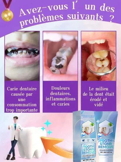 Whitening Toothpaste – Gum Care, Plaque & Stain Removal
