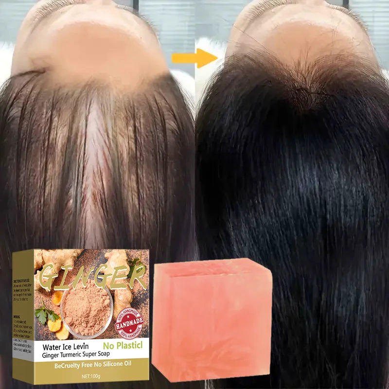 Turmeric Super Soap Shampoo Cold Process Soap Shampoo Shampoo Bar Pure Plant Shampoo Shampoo Hair Treatment Oasis Select