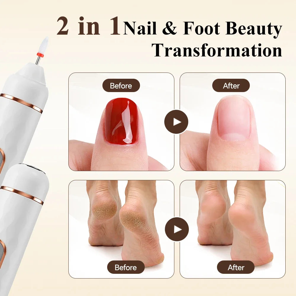 AFDEAL 2-in-1 Cordless Nail Drill & Electric Foot Callus Remover