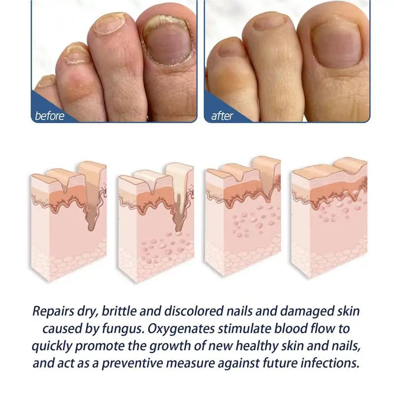 Instant Foot Peeling Spray Heel Scraper Corn Remover Callus And Dead Skin Remover For Feet Gentle Formula For Cracked Oasis Select