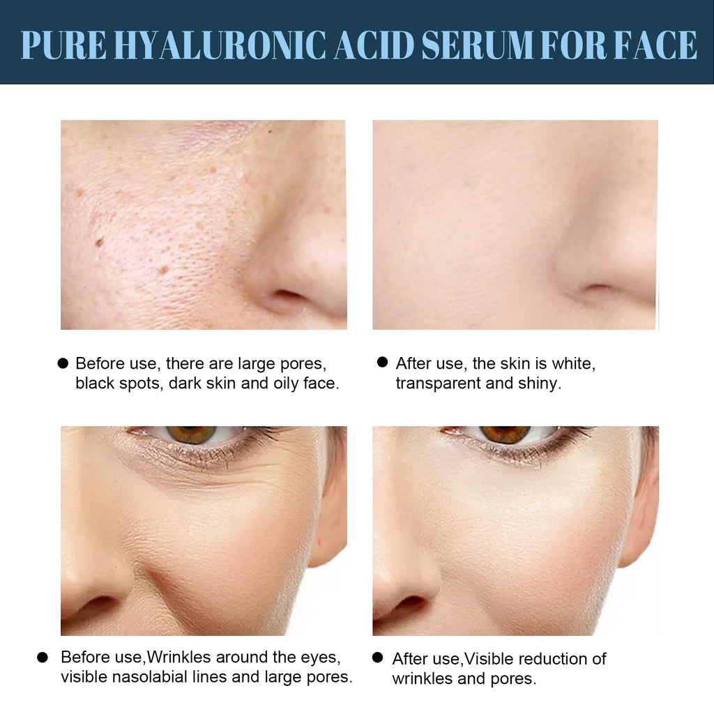 Eelhoe 60pcs Collagen Protein Thread Serum – No-Needle Filler Collagen Face Serum Oasis Select
