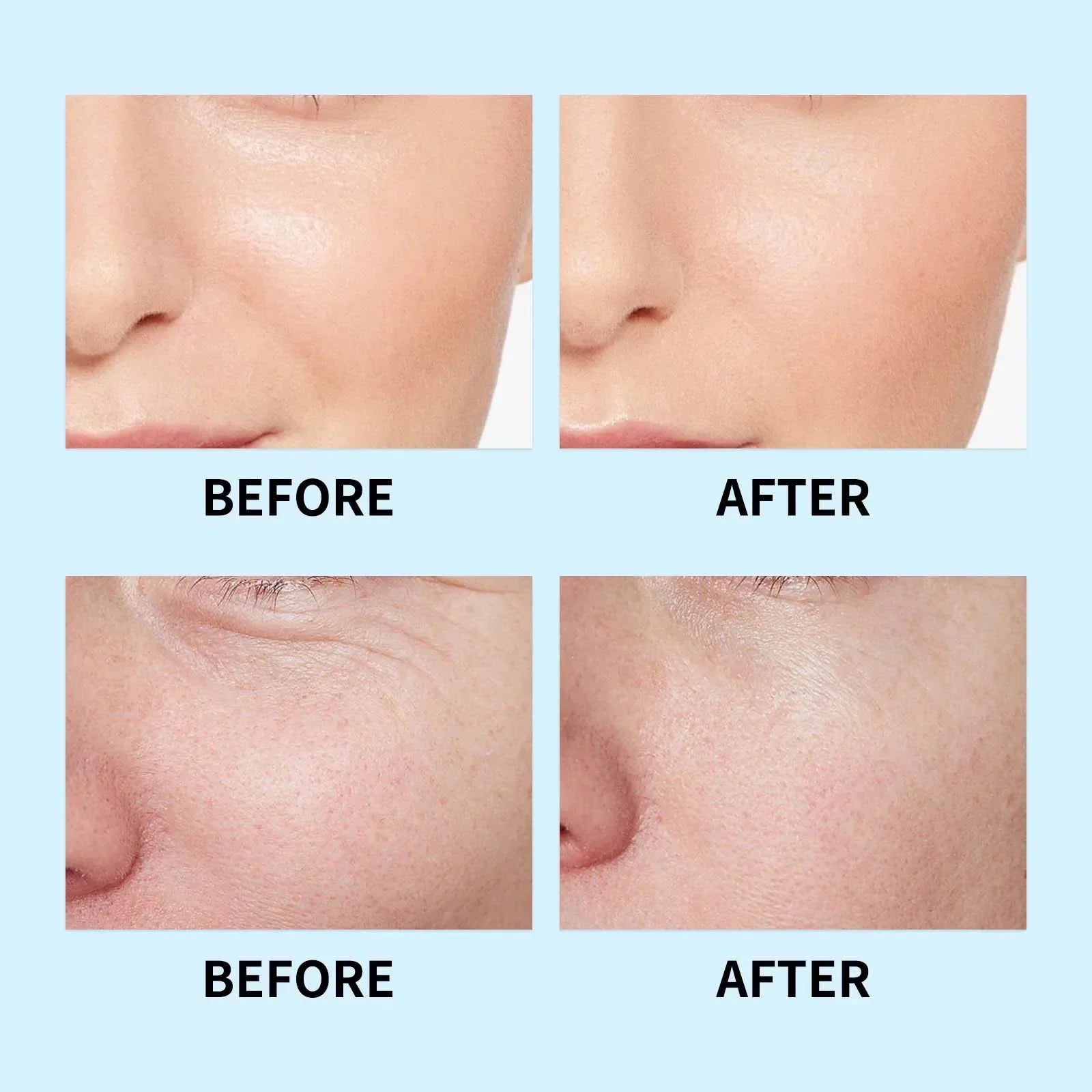 Hyaluronic Acid Face Serum – 3D Moisturizing Lifting Essence Hyaluronic Acid Serum Oasis Select